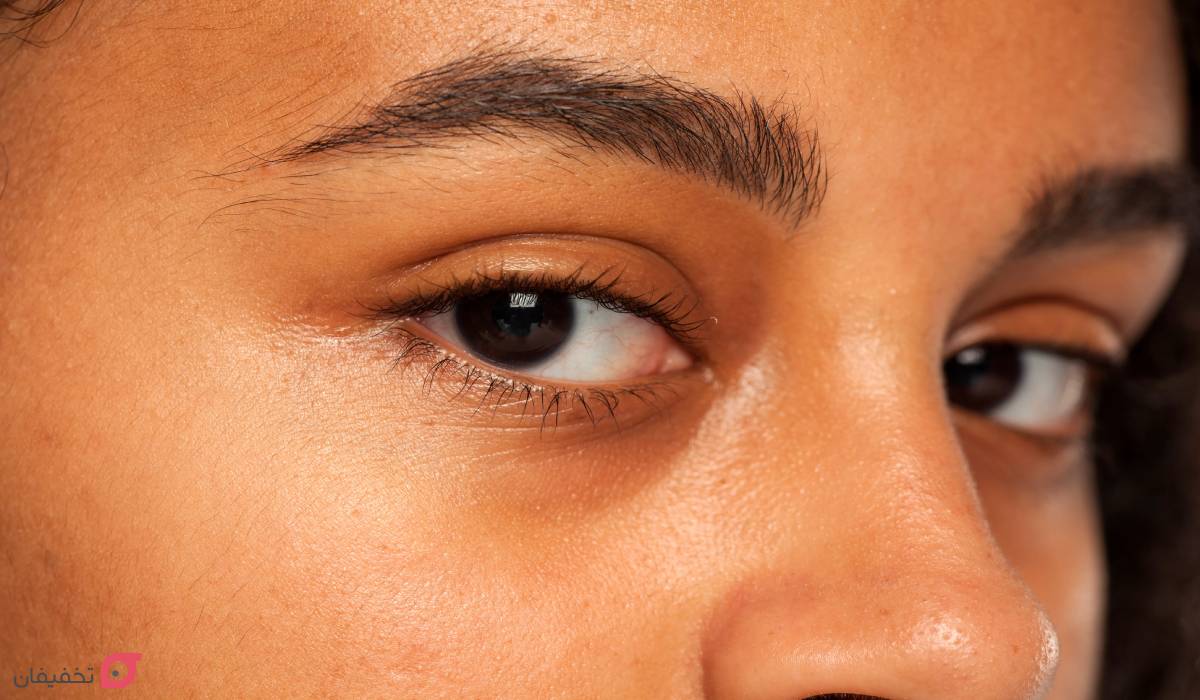 فیلر زیر چشم چند روز بعد اثر می کند؟