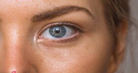 فیلر زیر چشم چند روز بعد اثر می کند؟