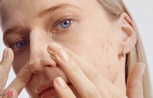 جوش روی بینی نشانه چیست | 8 درمان سریع و همیشگی در خانه 26 جوش روی بینی