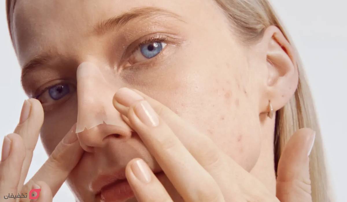 جوش روی بینی