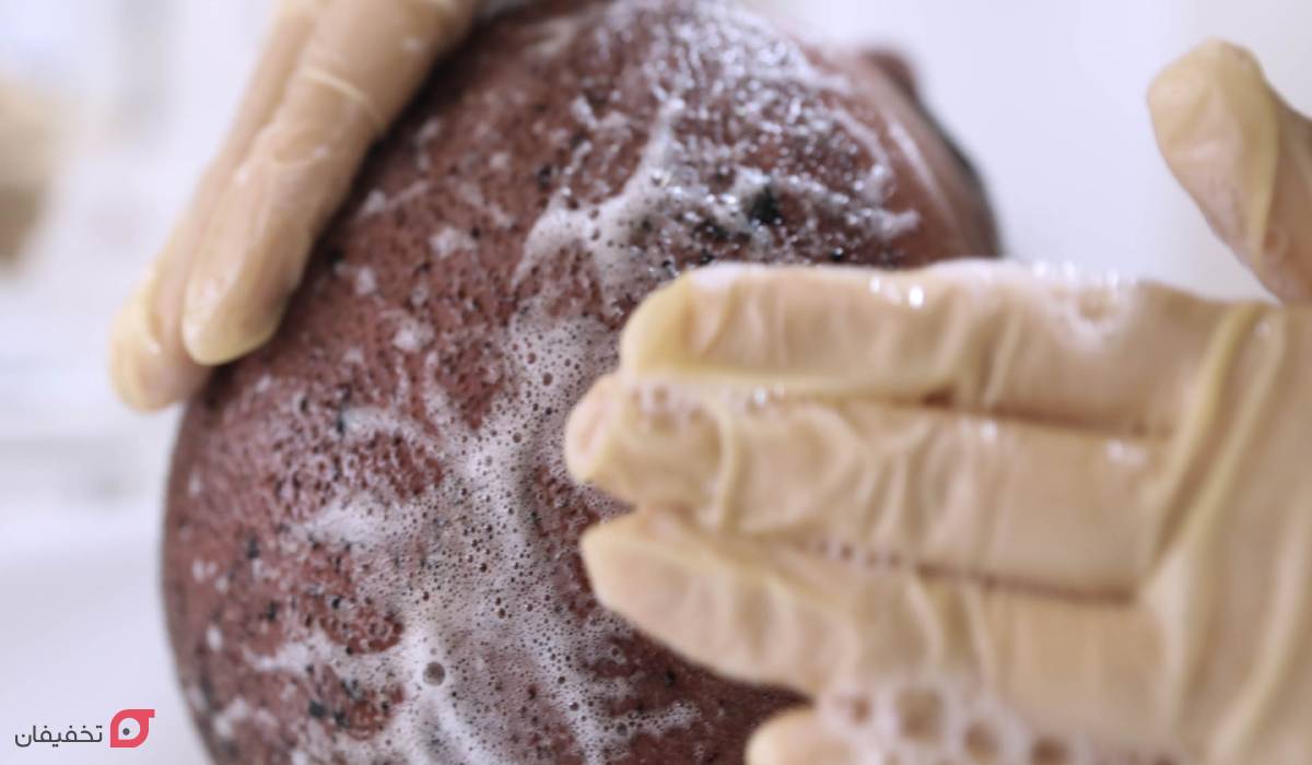 مراقبت بعد از کاشت مو