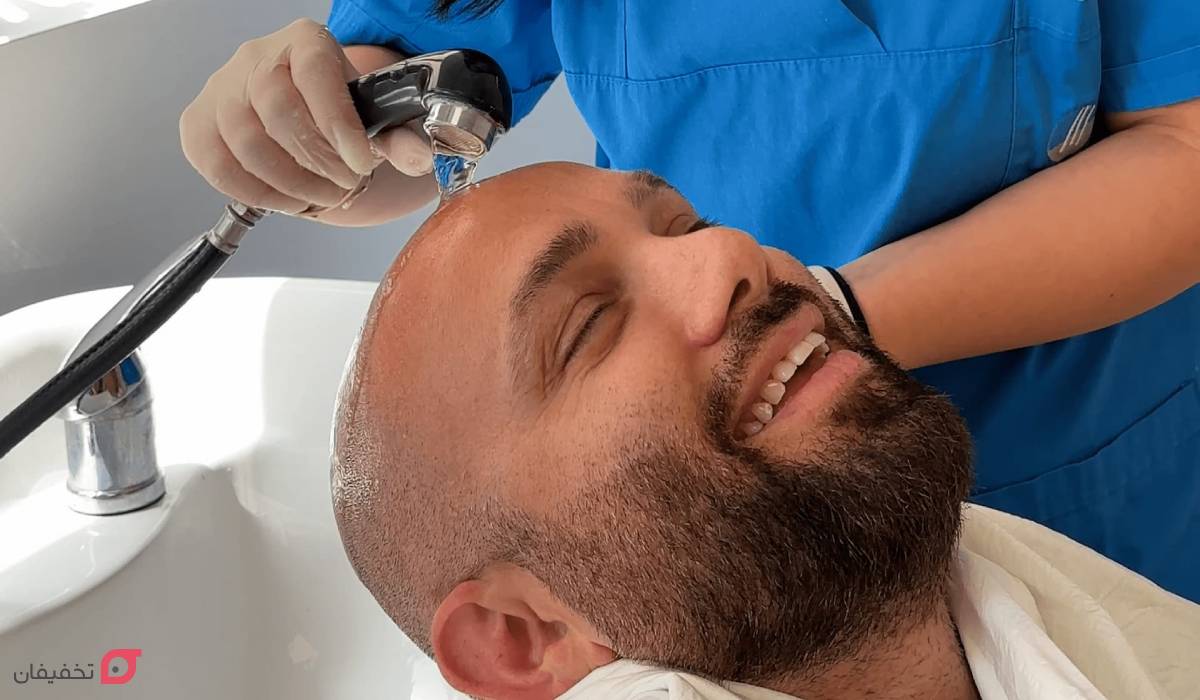 نحوه اولین شستشو بعد از کاشت مو