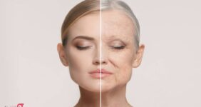 بهترین و سریعترین روش برای جوانسازی و سفتی پوست صورت