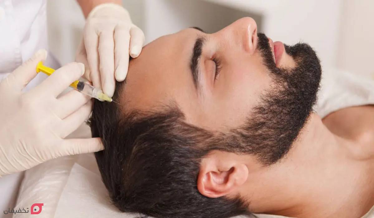 انواع ریزش مو و دلایل آن؛ نحوه تشخیص الگو و نوع ریزش با عکس 11 درمان ریزش مو