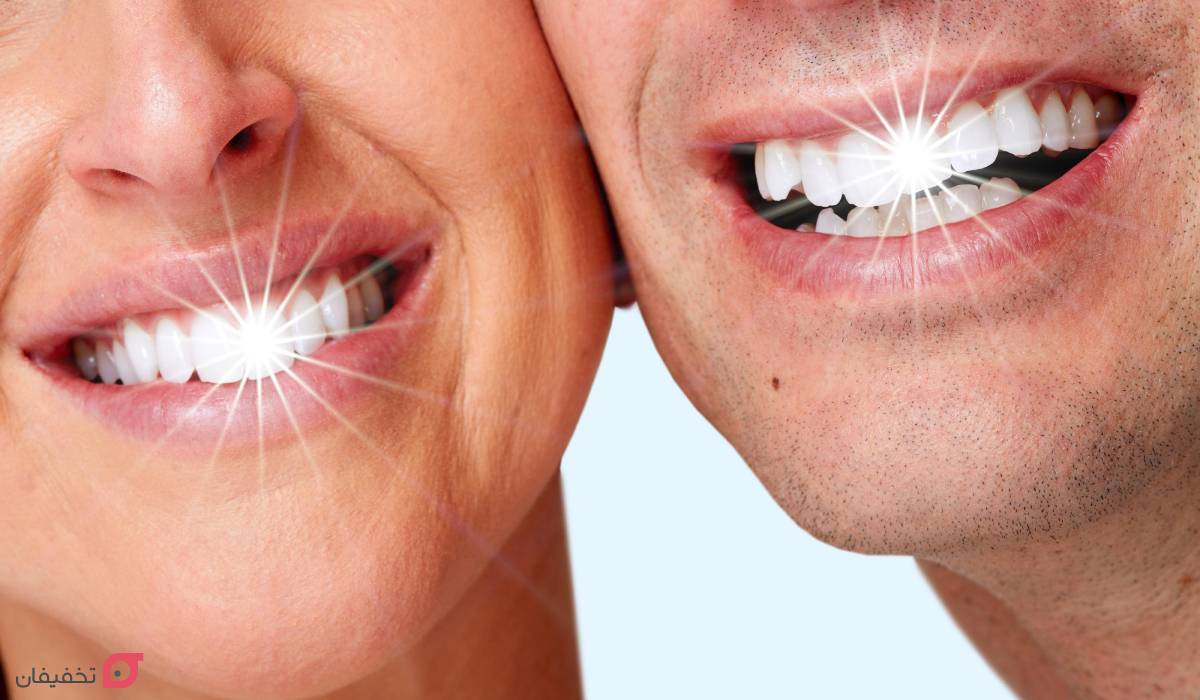 بلیچینگ دندان چقدر دوام دارد؟