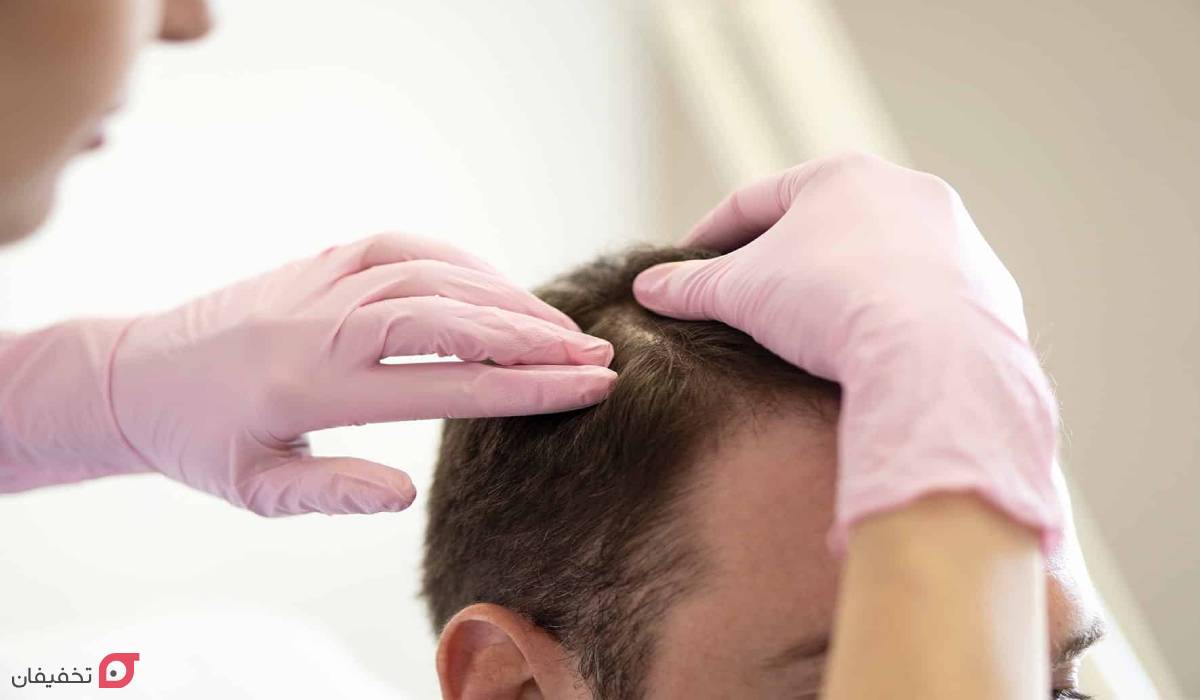 انواع ریزش مو و دلایل آن؛ نحوه تشخیص الگو و نوع ریزش با عکس 9 تشخیص نوع ریزش مو