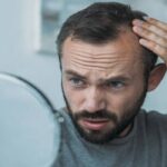 انواع ریزش مو و دلایل آن؛ نحوه تشخیص الگو و نوع ریزش با عکس 24 انواع ریزش مو