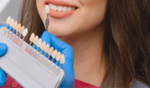 مراحل لمینت دندان با عکس | ۱۱ مرحله با توضیح کامل و تصاویر