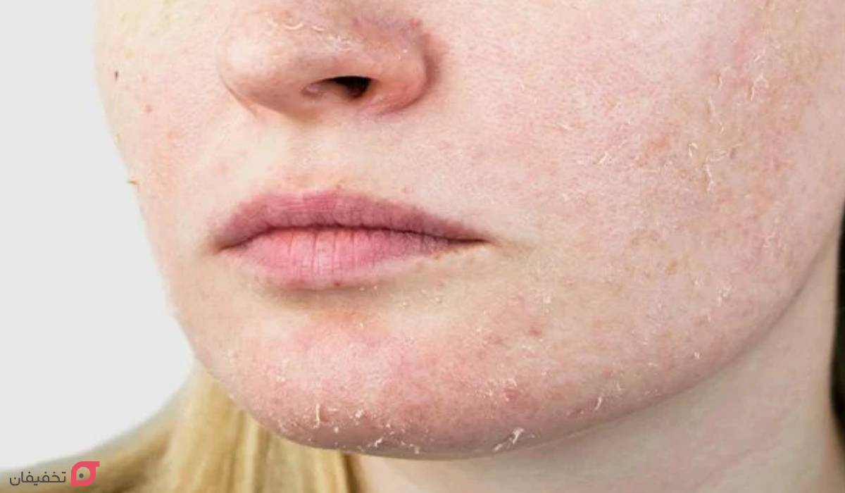 بهترین اسکراب صورت برای پوست خشک | 6 مارک + 5 اسکراب خانگی 3 انواع پوست خشک