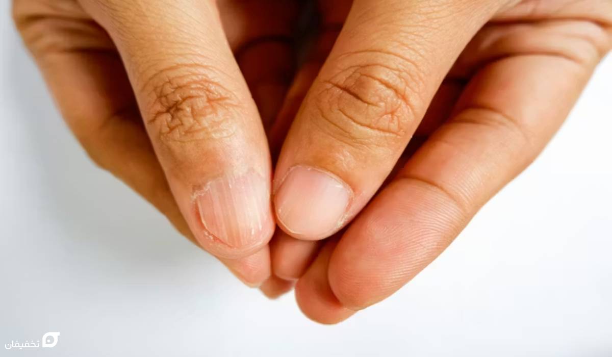 علائم کمبود آهن در مردان؛ علت و عوارض + 6 درمان سریع 6 علائم کمبود آهن در مردان