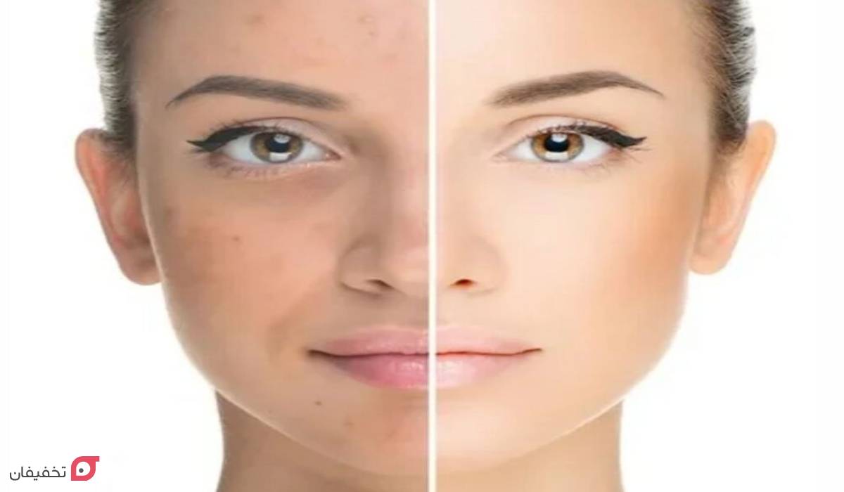 علت پیری پوست چیست؟