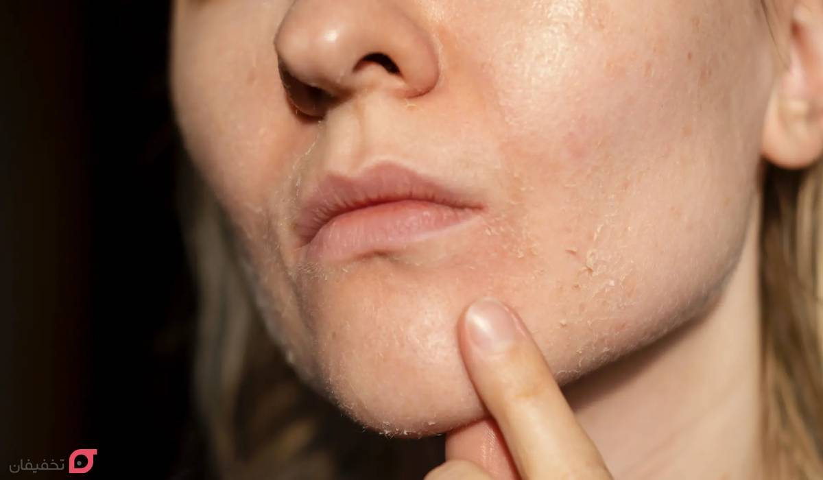 بهترین اسکراب صورت برای پوست خشک | 6 مارک + 5 اسکراب خانگی 2 انواع پوست خشک