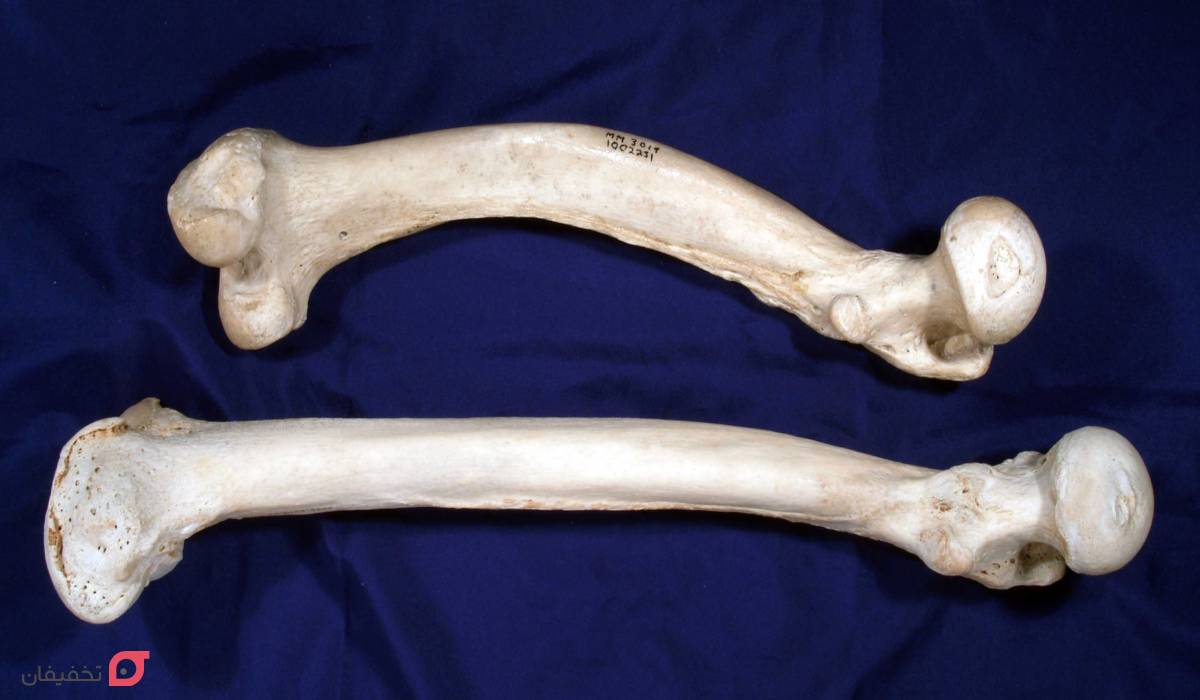 نرمی استخوان چیست | علت، علائم و درمان قطعی خانگی بزرگسالان 2 نرمی استخوان چیست؟