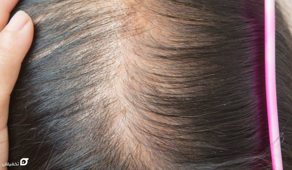 علائم کمبود آهن در مردان؛ علت و عوارض + 6 درمان سریع 8 کمبود آهن در مردان چه عوارضی دارد؟