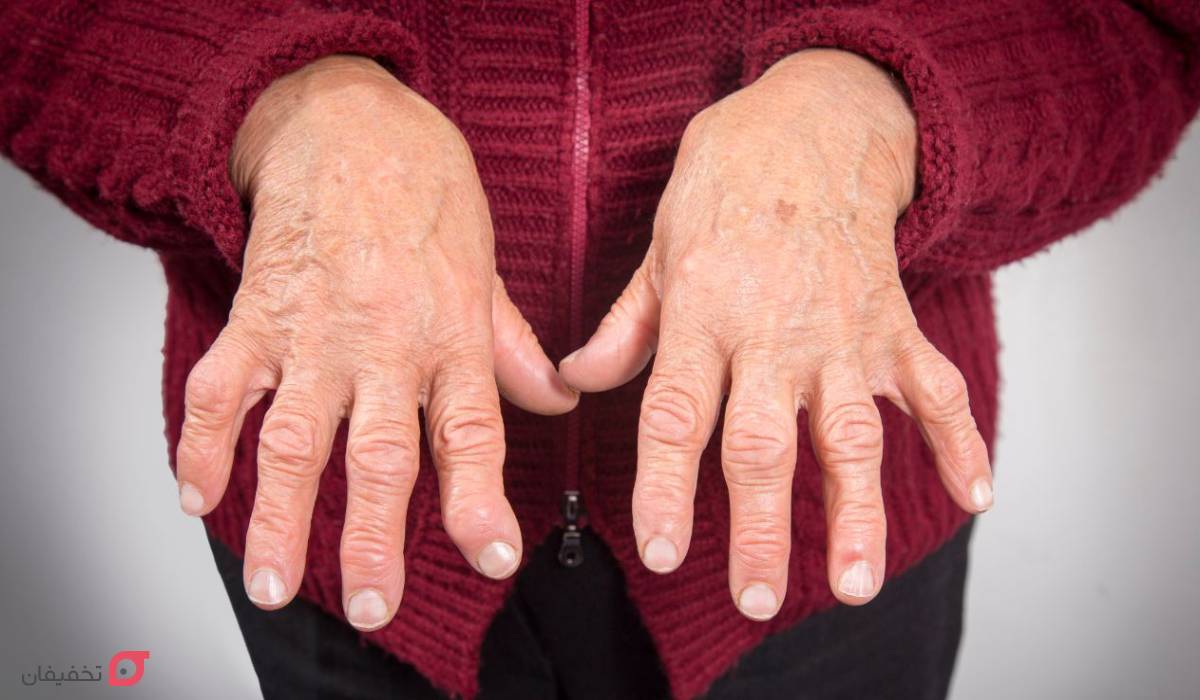 نرمی استخوان چیست | علت، علائم و درمان قطعی خانگی بزرگسالان 4 نرمی استخوان