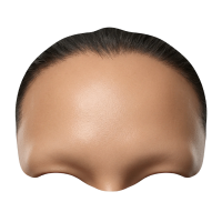 forhead-botox